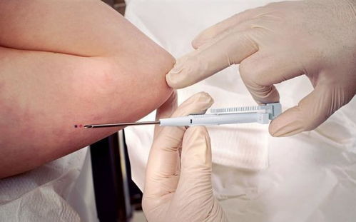 孕酮低胚胎發(fā)育一定差 孕酮低是偽命題 僅兩類孕媽要重點查它