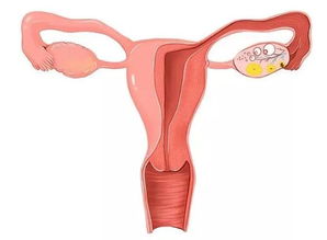 補佳樂 促進內膜生長,為胚胎寶寶 搭好溫暖的床