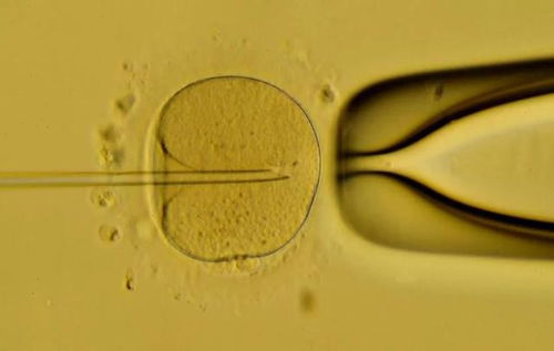 大齡女性備孕1年仍懷不上怎么辦 生殖專家 別犯愁,還有這6招