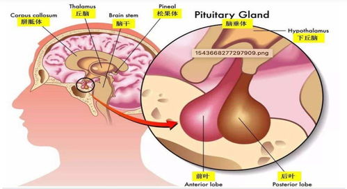 得了垂體瘤必須做手術(shù)嗎