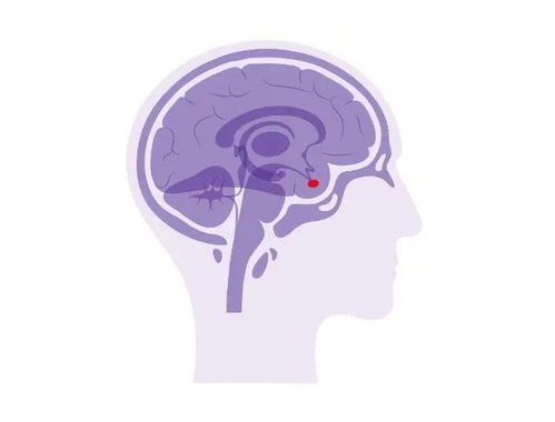 突然變胖變丑視力下降？警惕垂體瘤影響生殖激素