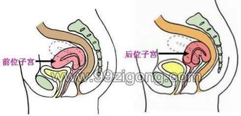 子宮常見的三種病變與生殖激素的關系