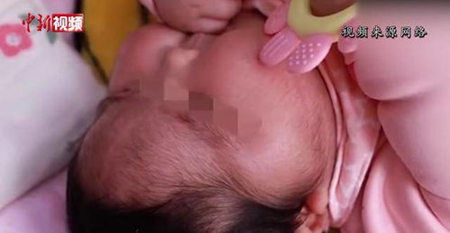 “嬰兒霜致大頭娃娃”事件進展 產品含生殖激素，涉案人員已被傳喚